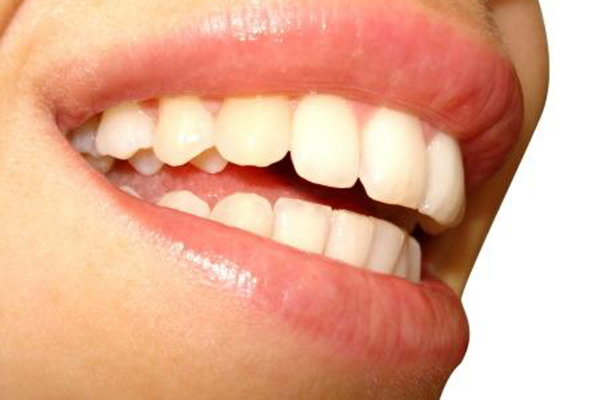 合肥兒童牙齒涂氟好處多多？