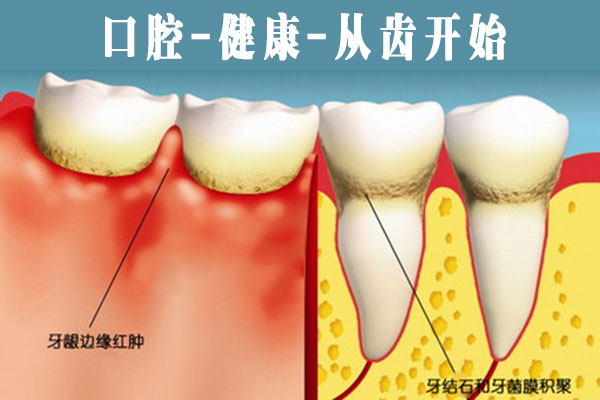 牙齒疾病怎么治療？